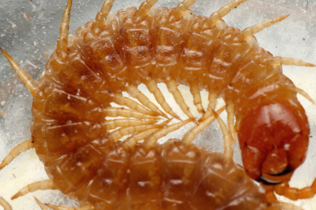 shows the presence of diagnostic sternal fossae